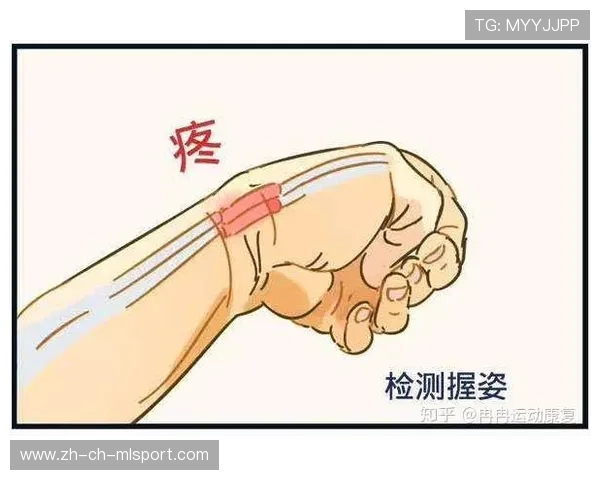 理疗师:手腕按出腱鞘炎的双手,手腕腱鞘炎按回去 理疗师:手腕按出腱鞘炎的双手,手腕腱鞘炎按回去